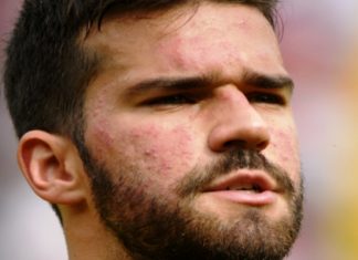 Alisson Becker